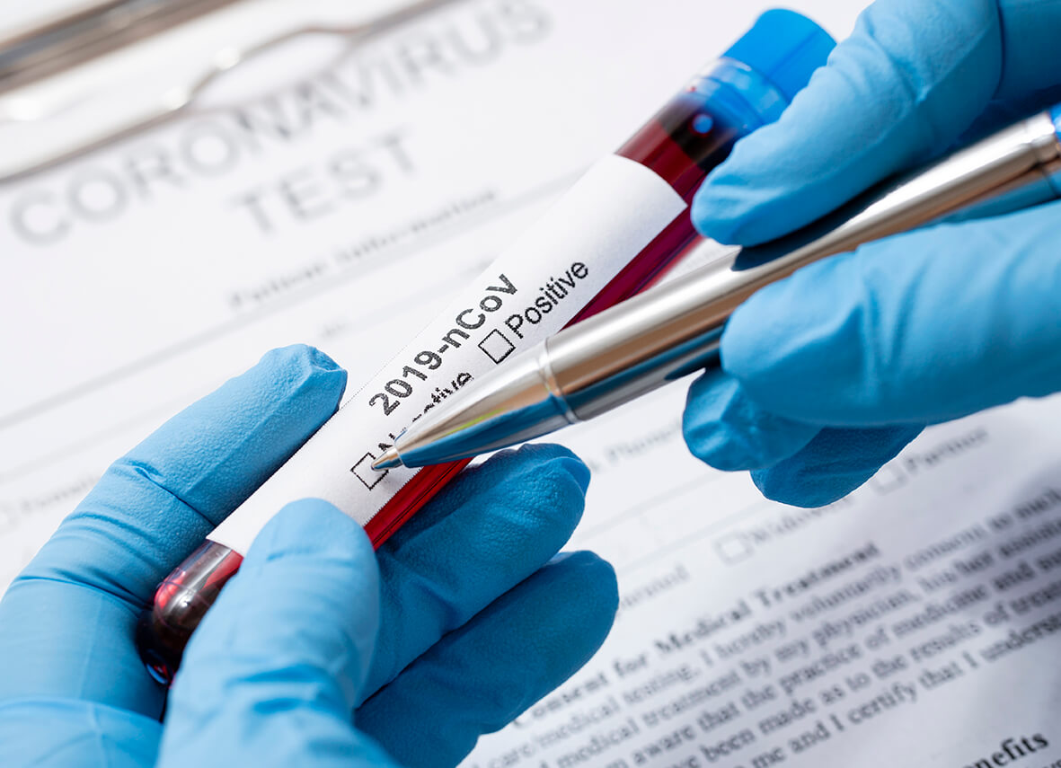 covid 19 test sample